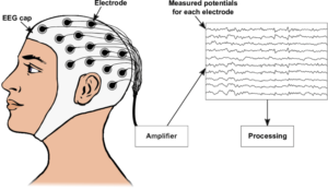 Electroencephalogram 